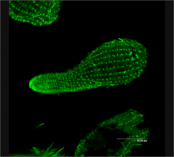 β-tubulin in Tetrahymena (a ciliated protozoan).