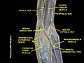 Basilic vein