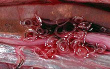 Anisakid larvae in the body cavity of an Atlantic herring