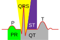 Drawing of the EKG, with labels of intervals P=P wave, PR=PR segment, QRS=QRS complex, QT=QT interval, ST=ST segment, T=T wave.